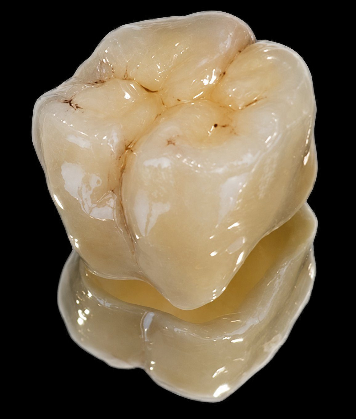 Couronne unitaire postérieure en zircone pleine, sur teintier VITA